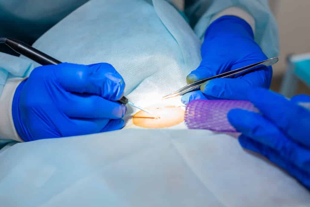 treinamento microcirúrgico