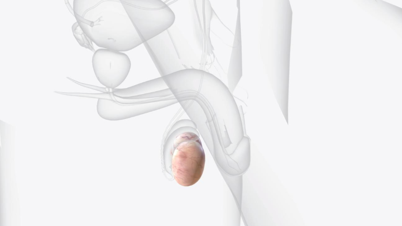 Testículos em visão de raio x, para falar sobre tratamento de varicocele